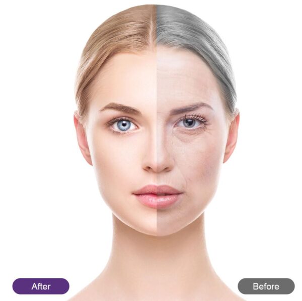 LOPHE Face Lifting Tape, 288 PCS Anti-Falten-Streifen für das Gesicht, Hautpflege-Pads zum Glätten von Augen, Mund & Stirn, Antialterung Anti-Falten-Pflaster Behandlung für Lifting über Nacht – Bild 4
