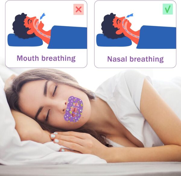 60 Stück Mundpflaster Schlafen Schnarchstopper Anti Schnarch Mouth Tape für Sleeping Schnarchpflaster Sleep Tape Gegen Schnarchen für Besser Atmen für Breathing Entwickelt Nasenatmungsgewohnheiten – Bild 3