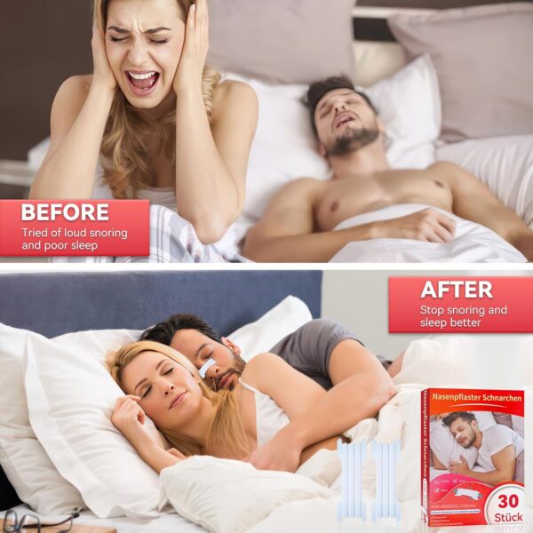 Nasenpflaster Schnarchen,30 Stück Nasenstrips Transparent Nasenpflaster Besser Atmen Nose Strips Lindern Eine Verstopfte Nase Aufgrund Schnupfen, Allergien,Nasal Strips für Schlaf Und Sport – Bild 5