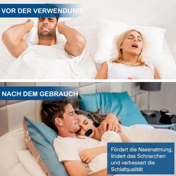 Scettar Mundpflaster Gegen Schnarchen, 50 Stück Schwarz Mouth Tape for Sleeping, Schnarchpflaster Verbessert das Durch Mundatmung Verursachte Schnarchen, Mundpflaster Schlafen Geeignet für Mundform – Bild 3