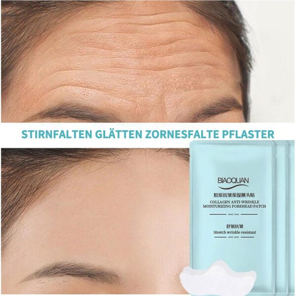 Shefave Stirnfalten Glätten Zornesfalte Pflaster 20 Stück, Hydrogel Pflaster Stirn Pad Gegen Falten, Collagen Maske Anti Falten Pflaster, Feuchtigkeit, Glättet Feine Linien und Fältchen – Bild 6