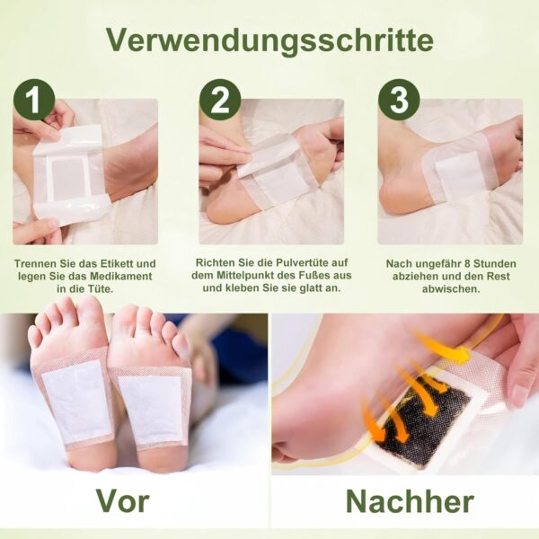 Freshmagis Entgiftungspflaster Füße, Ultra detox pflaster füsse entgiftung, Detox Fußpflaster zur Entgiftung für besseren Schlaf, rein natürliche fusspflaster zum entgiften - 20Stück – Bild 4