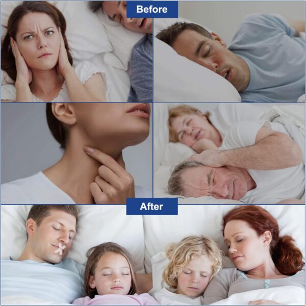 Mouth Tape For Sleeping 120 Pcs Mundkleber Nacht Mundpflaster Schlafen Schnarchpflaster Und Anti Schnarch Pflaster Schnarchstopper Mund Tape Schlaf für Schnarchen Verhindern Besser Schlafen Und Atmen – Bild 8